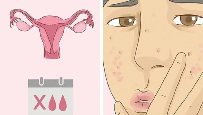 How to Recognize and Treat PCOS Depression