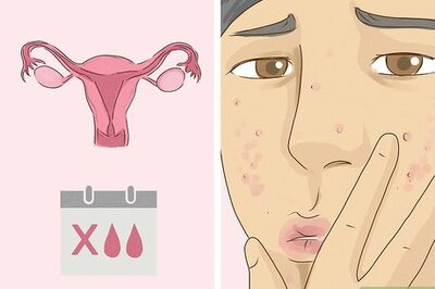 How to Recognize and Treat PCOS Depression