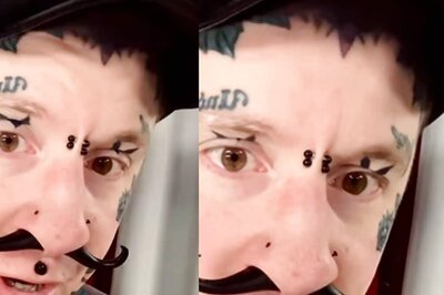 This Man’s Shocking Nose Transformation Video Has Everyone Talking