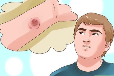 How to Treat a Paintball Welt