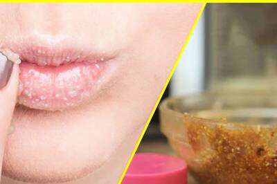 DIY Scrubs You Must Try Right Away For Plump and Healthy Lips