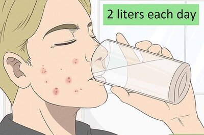 How to Clear Bad Skin