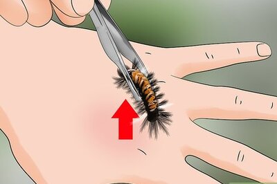 How to Treat a Caterpillar Sting