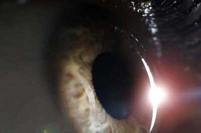 Tips to Take Care of Your Eyes Post-cataract Surgery