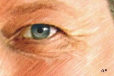 Anti-aging supplements don't work: study