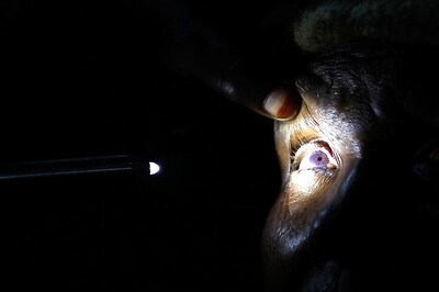 Zika Virus Infections Could Cause Eye Diseases