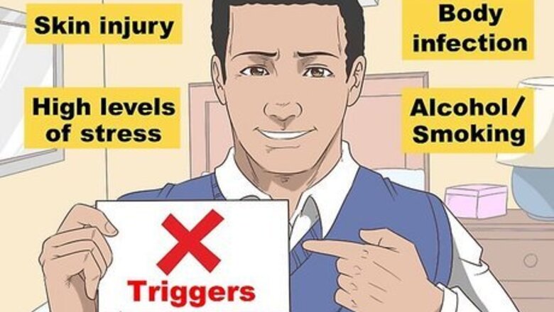 How to Care for Psoriasis