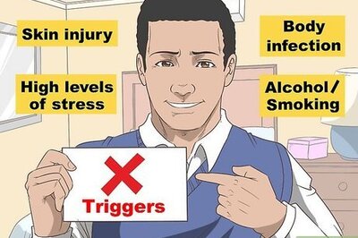 How to Care for Psoriasis