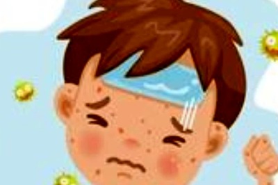 Here’s Everything That You Should Know About Measles