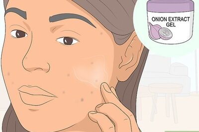 How to Get Rid of Acne Scars: Can Natural Remedies Help?