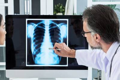 World Lung Cancer Day 2022: Types, Symptoms, Treatment and Prevention