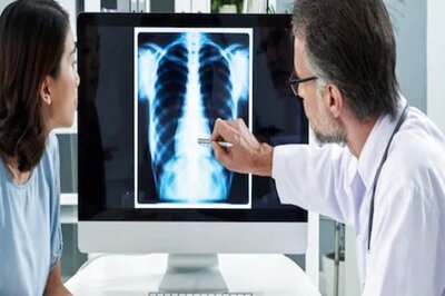 Early Signs of Lung Cancer. Consult Doctor If You Notice These Symptoms