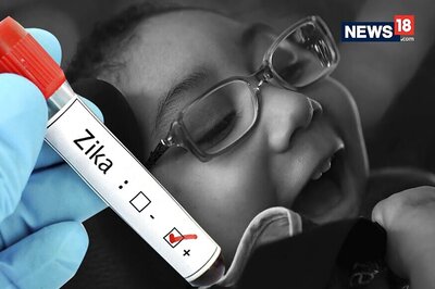 Zika Virus Had Quitely Spread in 40 Countries Before 2015-16 Epidemic, Says Research