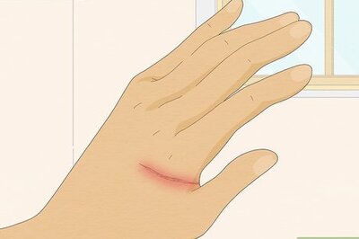 How to Cover Up Cuts