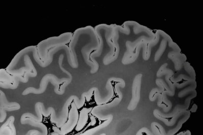 World's Most Powerful MRI Scans First Images Of Human Brain