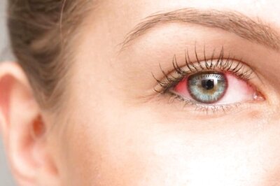 It's Monsoon Season And Here's What You do to Keep Eye Infections At Bay