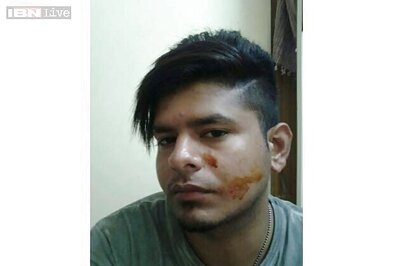 Bangalore college student alleges ragging, college suspends him