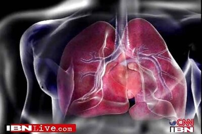 Strong muscles in kids lower heart disease, diabetes risk