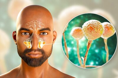 Explained: Difference Between Black Fungus, White Fungus, Yellow Fungus and Green Fungus