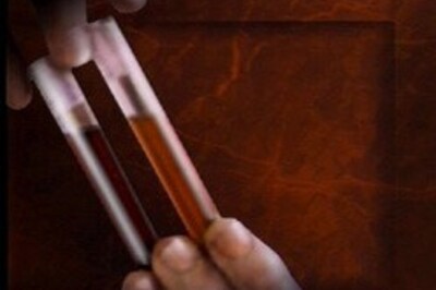 Stem cells created, embryos undestroyed