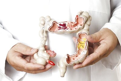 Anti-Gout Drug May Alleviate Bowel Disease