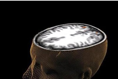 Brain Activity of Listeners Used to Recreate Classic Pink Floyd Number