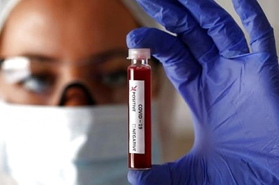 Hong Kong Man 'First Case' Documented of Getting Coronavirus Twice, Researchers Say