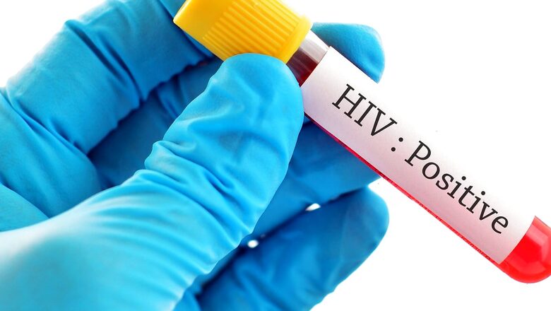 What are the Symptoms of HIV? Here’s What You Need to Do if Your Partner is HIV Positive