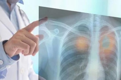 Research Says Time-restricted Eating Can Reduce Cardiovascular Disease Risk Among Aged Breast Cancer Survivors