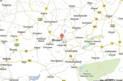 Minor girl's scalp ripped off in a Ferris wheel accident