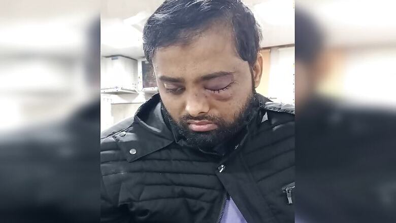 Student Who Lost One Eye in Jamia Violence Moves Delhi HC for SIT Probe & Compensation