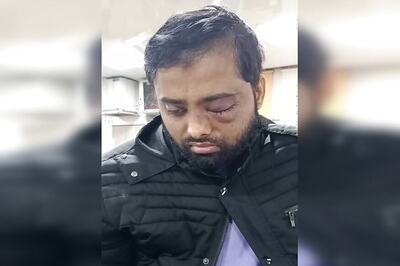 Student Who Lost One Eye in Jamia Violence Moves Delhi HC for SIT Probe & Compensation