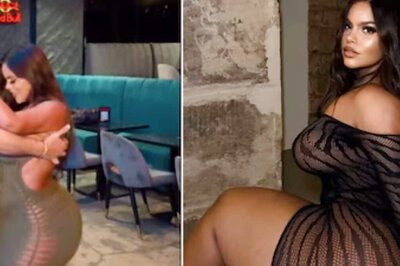 Woman, Suffering From Condition That Distorts Body Shape, Trolled For Salsa Dance