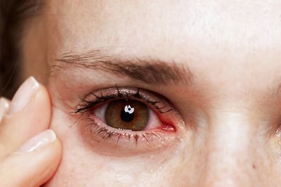 List Of Top 10 Most Dangerous Cosmetic Surgeries Based On Complication Rate