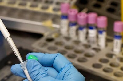 Understanding Monkeypox: Symptoms, Transmission, and Management