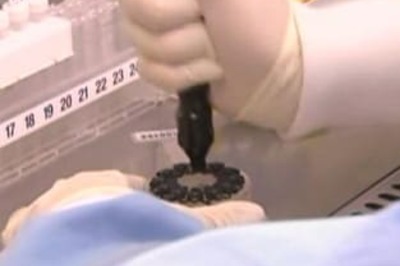 Bad bumps to head could kill years later: Study