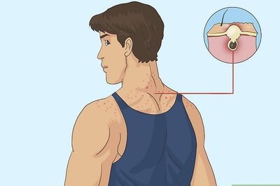 How to Tell If Someone Is on Steroids (With Pictures)