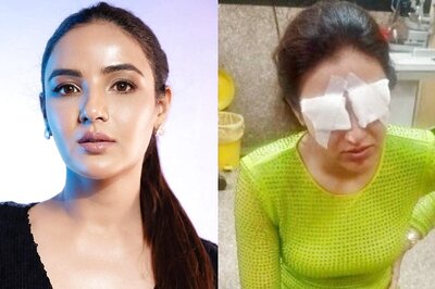 Jasmin Bhasin Removes Glasses to Show Her Eyes on Camera After Corneal Injury: 'Bilkul Achi Hai' | Watch